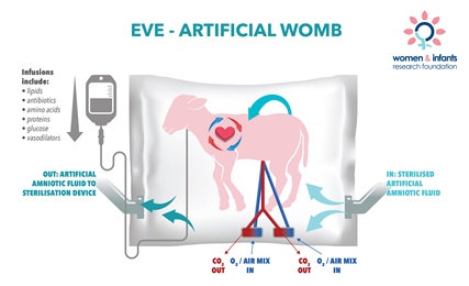 Artificial womb raises hope for premature babies