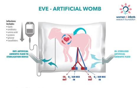 Artificial womb EVE Therapy teaser