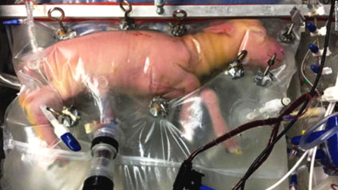 Artificial womb breaks its 4 minute mile