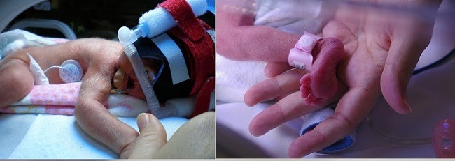 Holly and Nika’s story