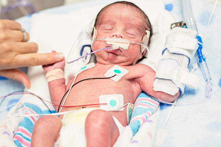 New study on antenatal steroid use