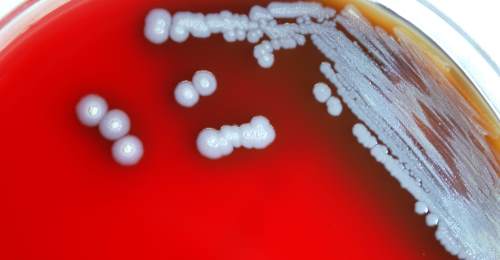 Agar