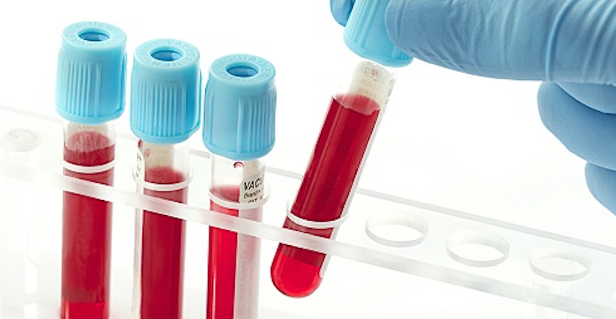 Blood test