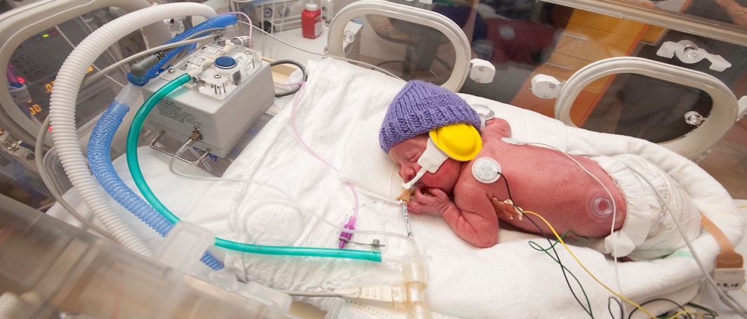 Prevention of preterm birth main